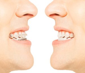 Dr oliviya heart, Virginia Biological Dentistry Proving charlottesville area invisalign