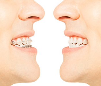 Dr oliviya heart, Virginia Biological Dentistry Proving charlottesville area invisalign