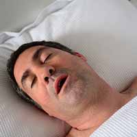 Sleep apnea describes interruption in breathing during sleep. Central sleep apnea is the result of faulty signals from the brain that trigger muscles to perform breathing processes.