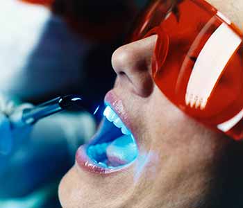 Dr. Hart uses a hard tissue laser to gently remove areas of decay, without drilling