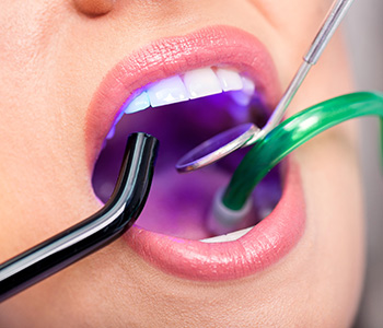 Laser Dentistry, Virginia Biological Dentistry
